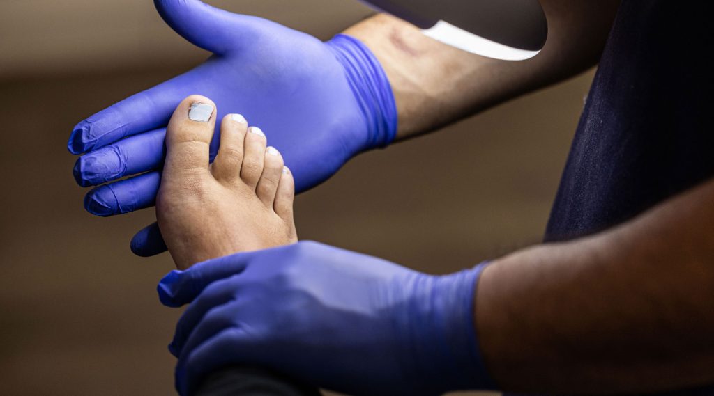 Ingrown Toenails Hero