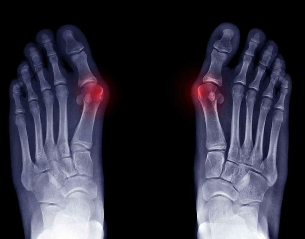 Regular checks and x-rays